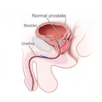 Što je dobro znati o prostati?